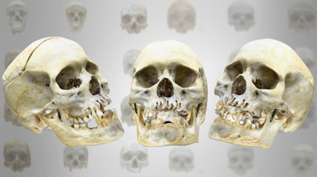 Projeto HumanTrace transforma acervo anatômico da UNIFAL-MG em atlas 3d digital interativo de crânios humanos para ensino e pesquisa