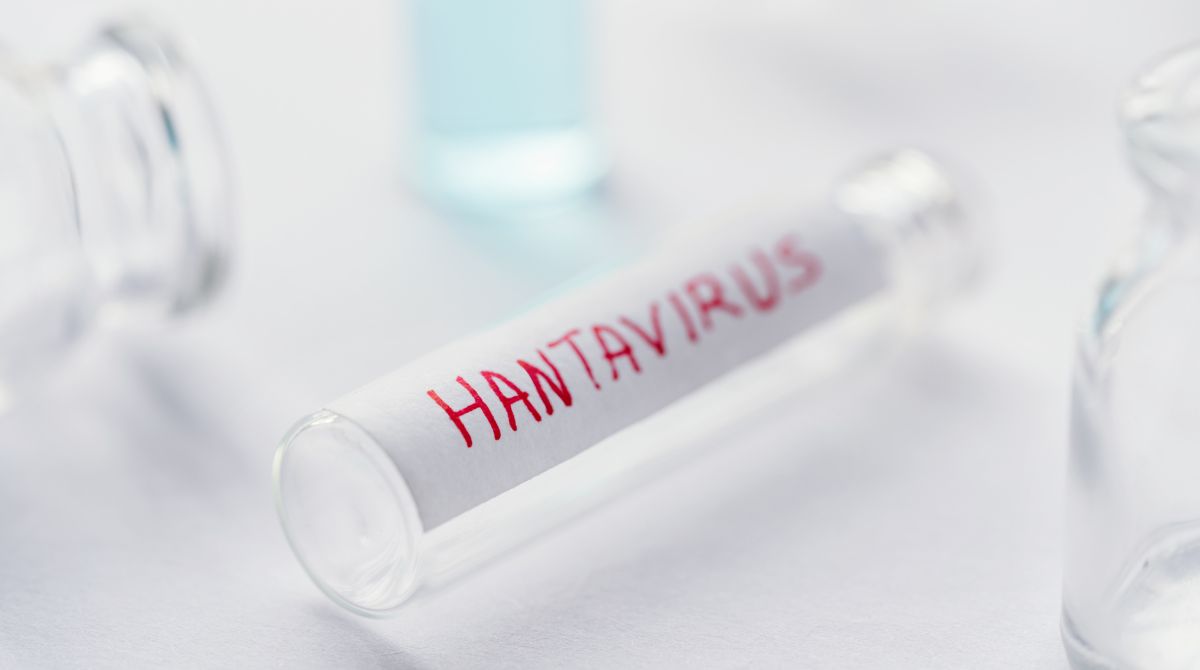 LAVI da UNIFAL-MG realiza palestra sobre Hantavírus no dia 10/06, no campus Sede da Universidade
